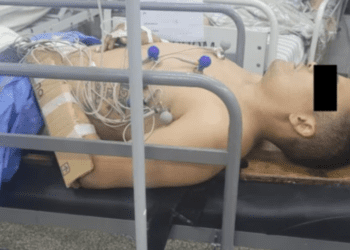 Intentó robarle el auto a una mujer policía en Mar del Plata y la pareja de la oficial le fracturó los dos brazos