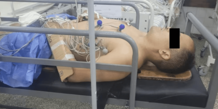 Intentó robarle el auto a una mujer policía en Mar del Plata y la pareja de la oficial le fracturó los dos brazos